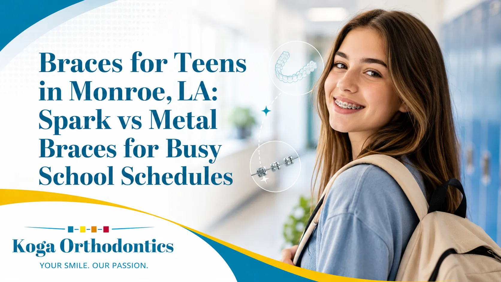 Braces for Teens in Monroe, LA: Spark vs Metal Braces for Busy School Schedules