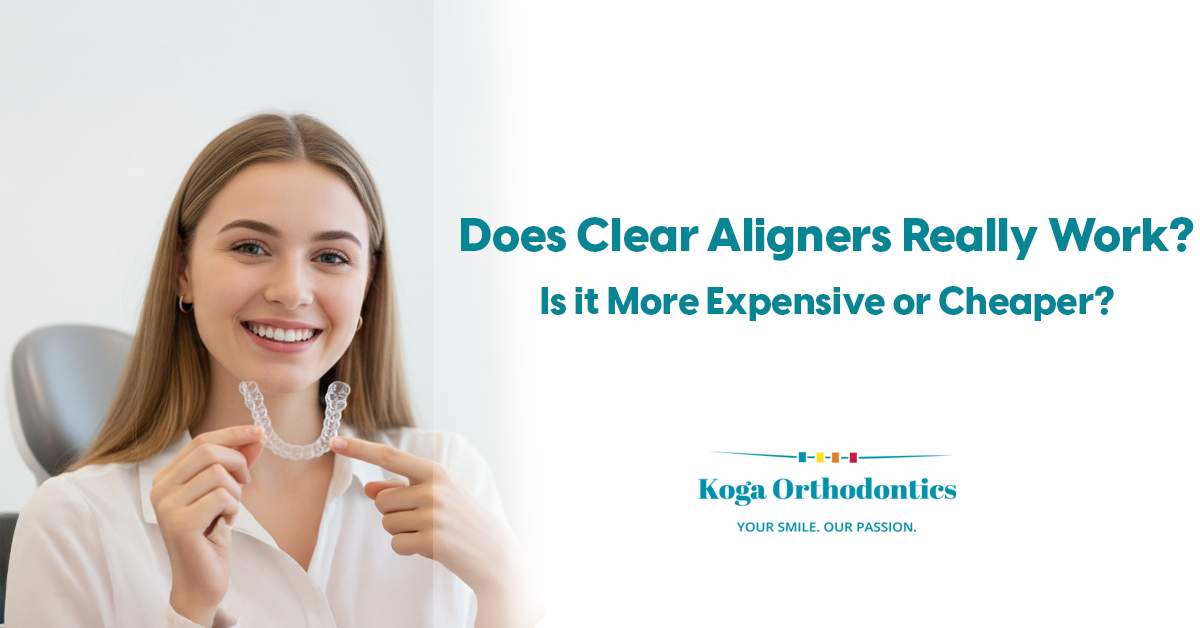 Does Clear Aligners Really Work? Is It More Expensive or Cheaper?