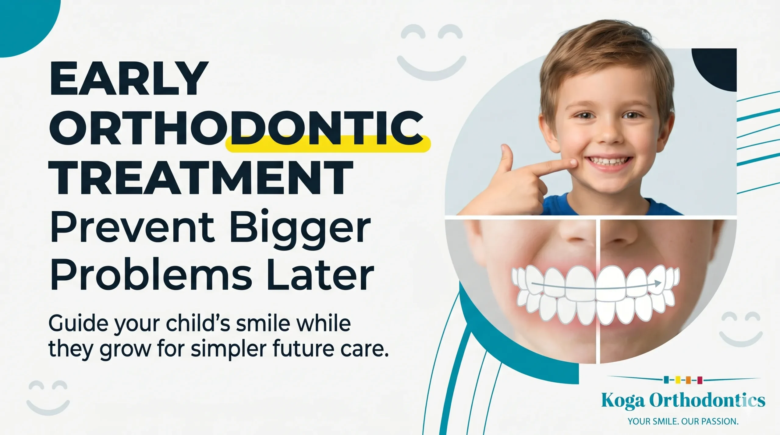 Early Orthodontic Treatment in Monroe & West Monroe, LA — Prevent Bigger Problems Later